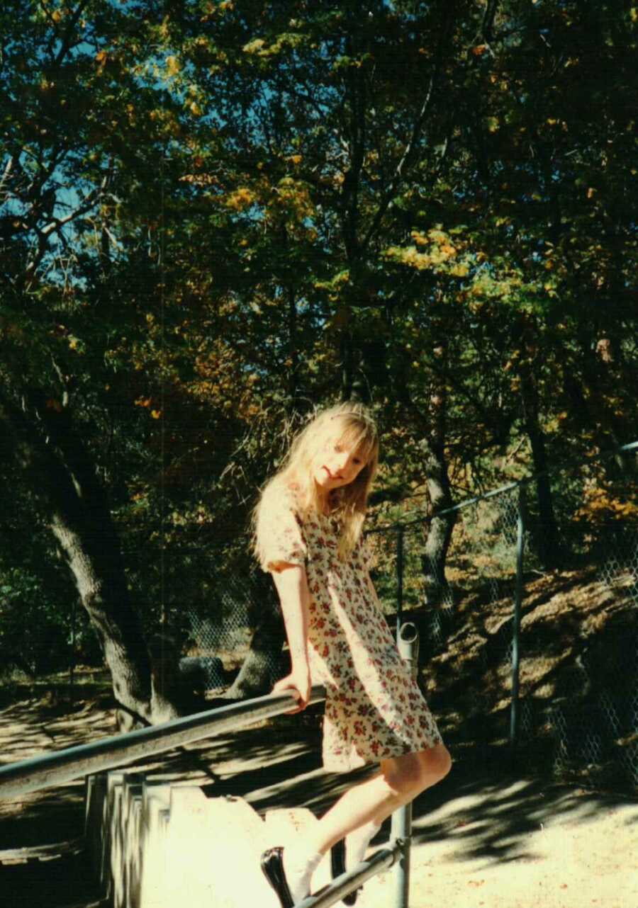 girl with Treacher Collins Syndrome sitting on railing