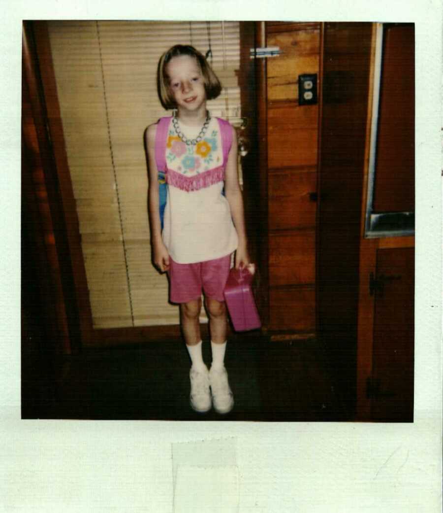 girl with Treacher Collins Syndrome standing ready for school