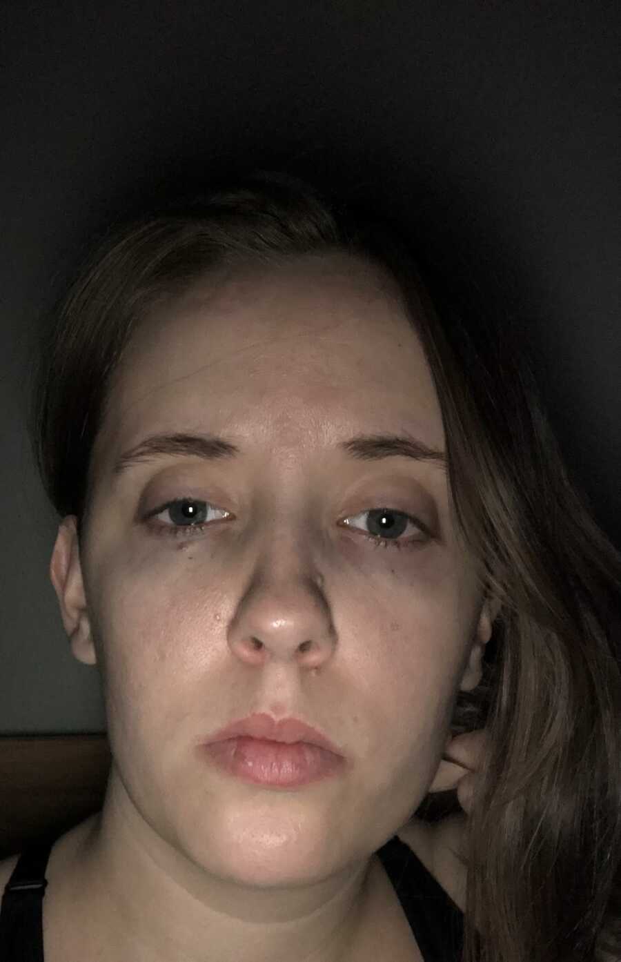 woman with lyme disease takes selfie in the dark looking tired